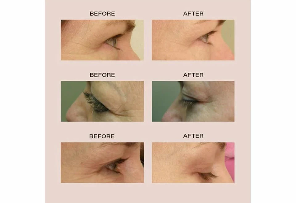 Wholesale π― Anti-Aging Red LED Glasses by Dastmalchi LLC - Vanity Planet π 4 Wholesale π― Anti-Aging Red LED Glasses by Dastmalchi LLC - Vanity Planet π - Image 4