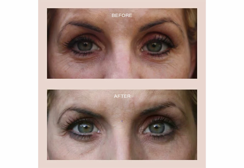 Wholesale π― Anti-Aging Red LED Glasses by Dastmalchi LLC - Vanity Planet π 9 Wholesale π― Anti-Aging Red LED Glasses by Dastmalchi LLC - Vanity Planet π - Image 9