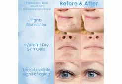 Discount 🎉 Professional Grade Facial Steamer by DAJ Distribution Inc. dba Onyx Distribution 🥰 -Cheap Home Store 208524 z3